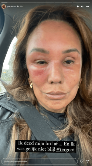 100%NL Magazine Patty Brard
